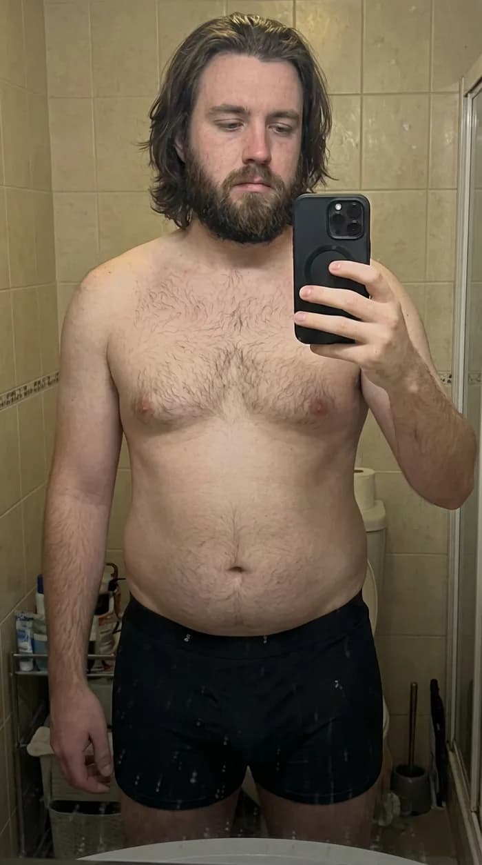 Brett K. before
